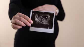 Woman holding ultrasound unsplash