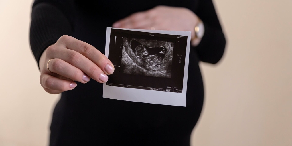 Woman holding ultrasound unsplash