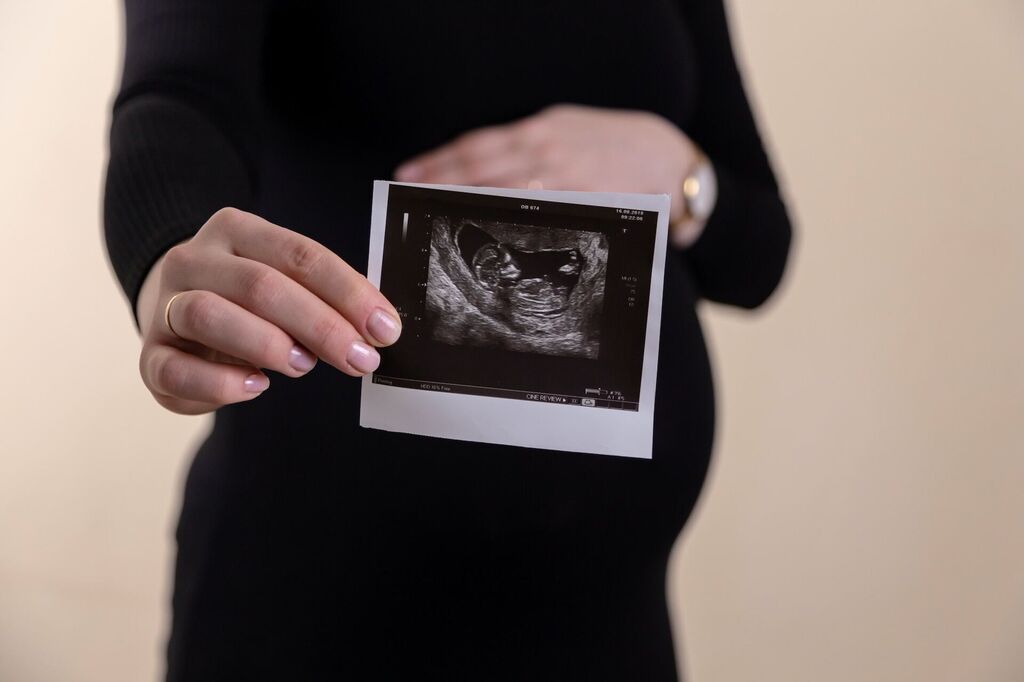 Woman holding ultrasound unsplash