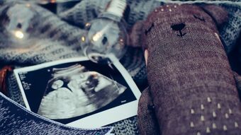 Baby scan daiga ellaby ND8movh PDLY unsplash