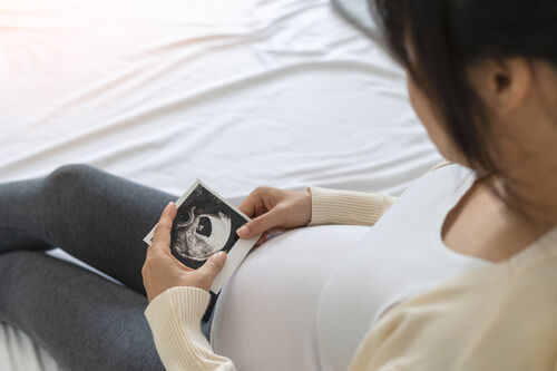 Pregnant pregnancy ultrasound scan baby woman