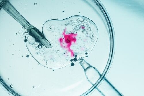 Embryo being fertilised in IVF