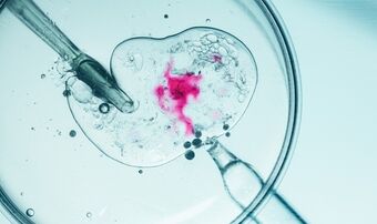Embryo being fertilised in IVF