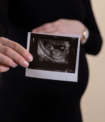 Pregnant pregnancy scan picture