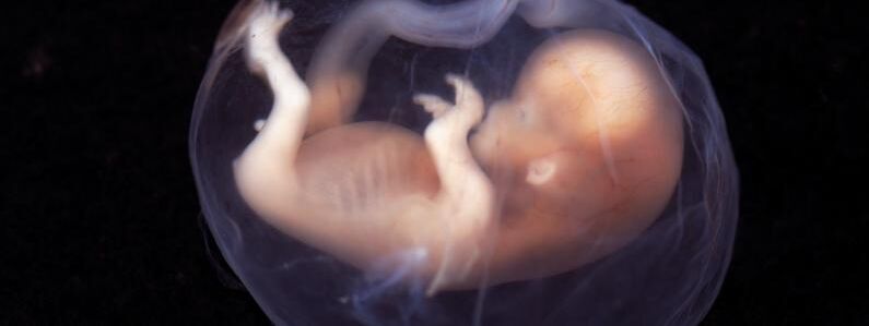 Flickr lunar caustic Fetus 2 9